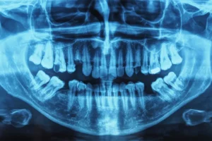 Radiation Safety – X-Ray