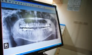 Digital Radiation and X-Ray Technique