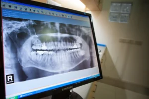 Digital Radiation and X-Ray Technique