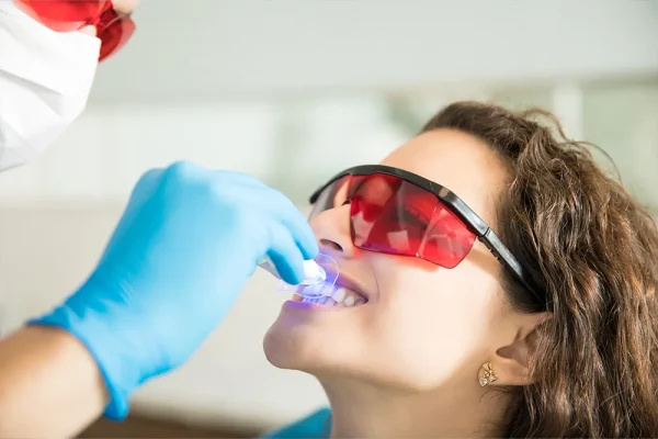 Tooth Whitening