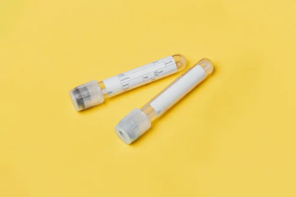 Breast Cancer Salivary Testing